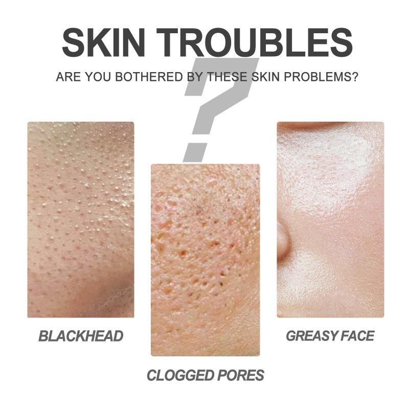 Маска для носа с черными точками и клубникой, очищающее масло для носа, средство от прыщей и угрей, набор для ухода за Т-зоной