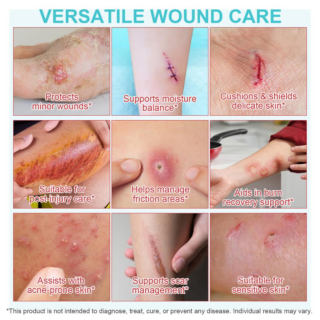 ГИДРОКОЛЛОИДНАЯ ПОДКЛАДКА-РУЛОН Подушечки для поврежденной кожи Патч для ухода за кожей, Кожный пластырь Удобный дышащий материал Удобный дизайн Для путешествий и домашнего использования