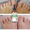 7DAYS Repair Nail Fungus Treatments Essence Foot Care Serum Toe Nails Fungal Removal Gel Anti-Infection