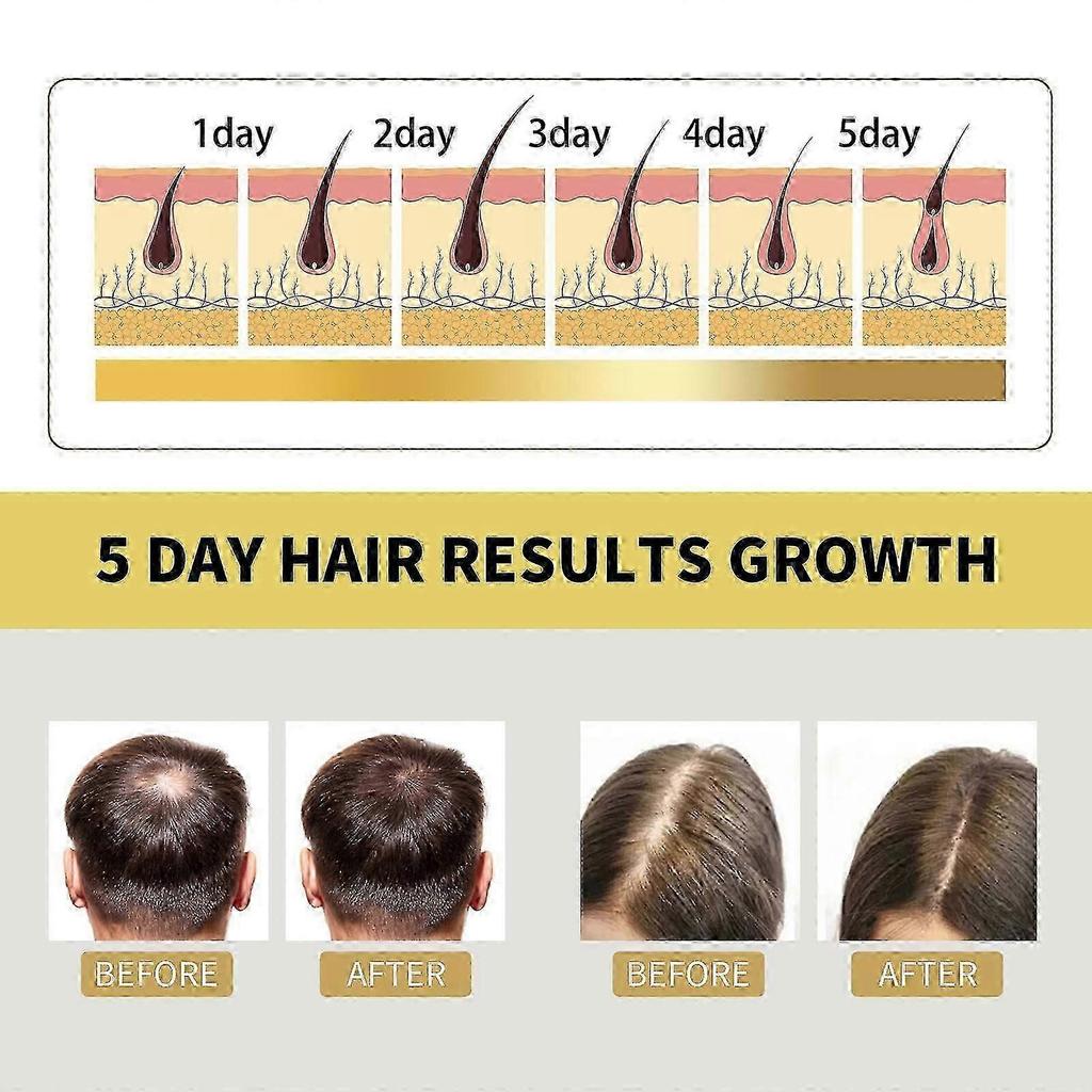 Ginger Shampoo for Hair Regrowth & Repair - Natural, Anti-Hair Loss, Suitable fo