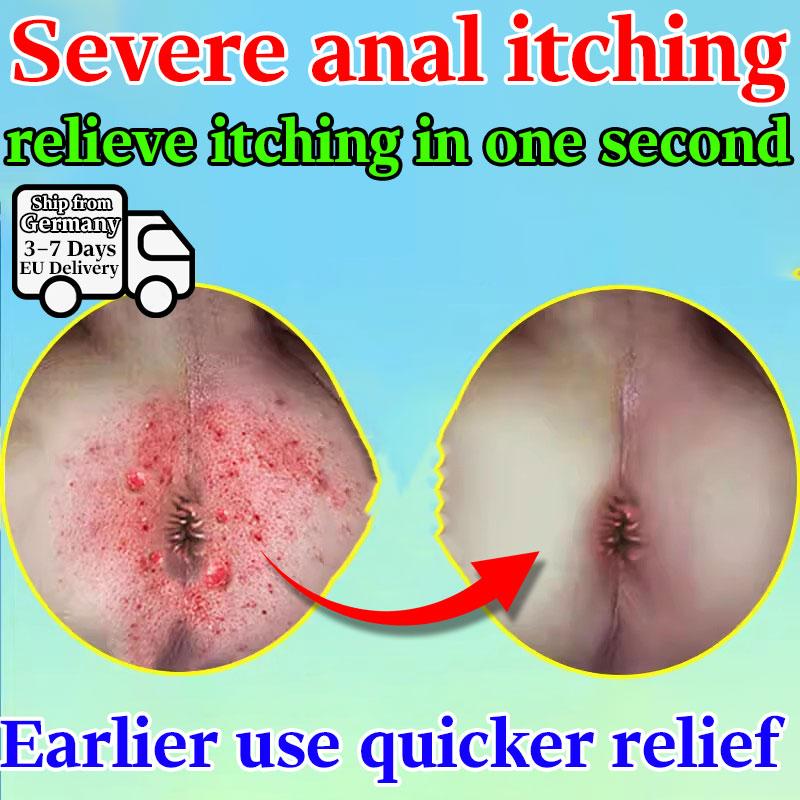 Herbal Itchy Anus Cream - Soothes Discomfort Gentle & Skin-Safe