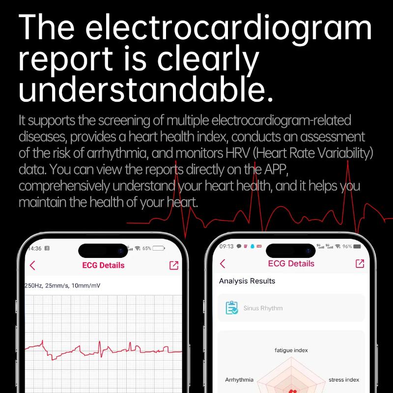 2025 New Uric Acid Blood Lipids Smart Watch Men ECG+PPG Blood Pressure Blood Oxygen Bluetooth Call Health Smartwatchs for IOS Android