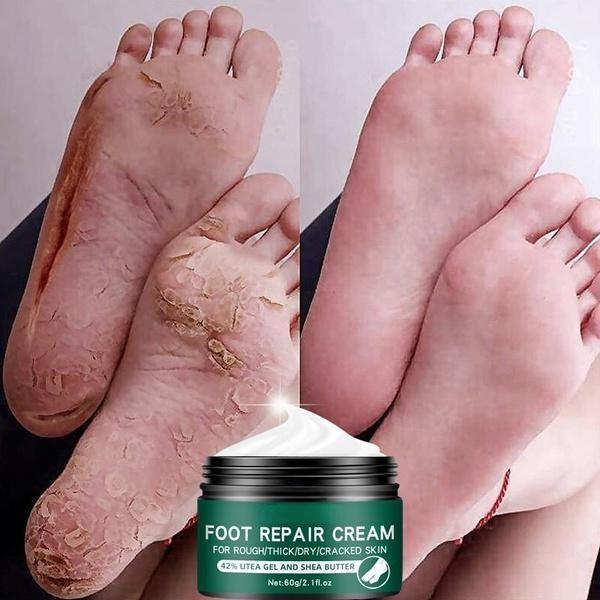 Новейший восстанавливающий увлажняющий крем для кожи рук и ног, против растрескивания, для грубых, сухих и потрескавшихся ног, крем для восстановления пяток