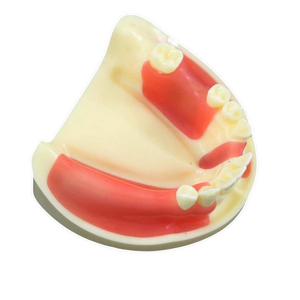 Dental Model Dentistry Implant Practice Training Model For Cutting Implant And Suturing Practice with Cancellous Bone Dental Lab