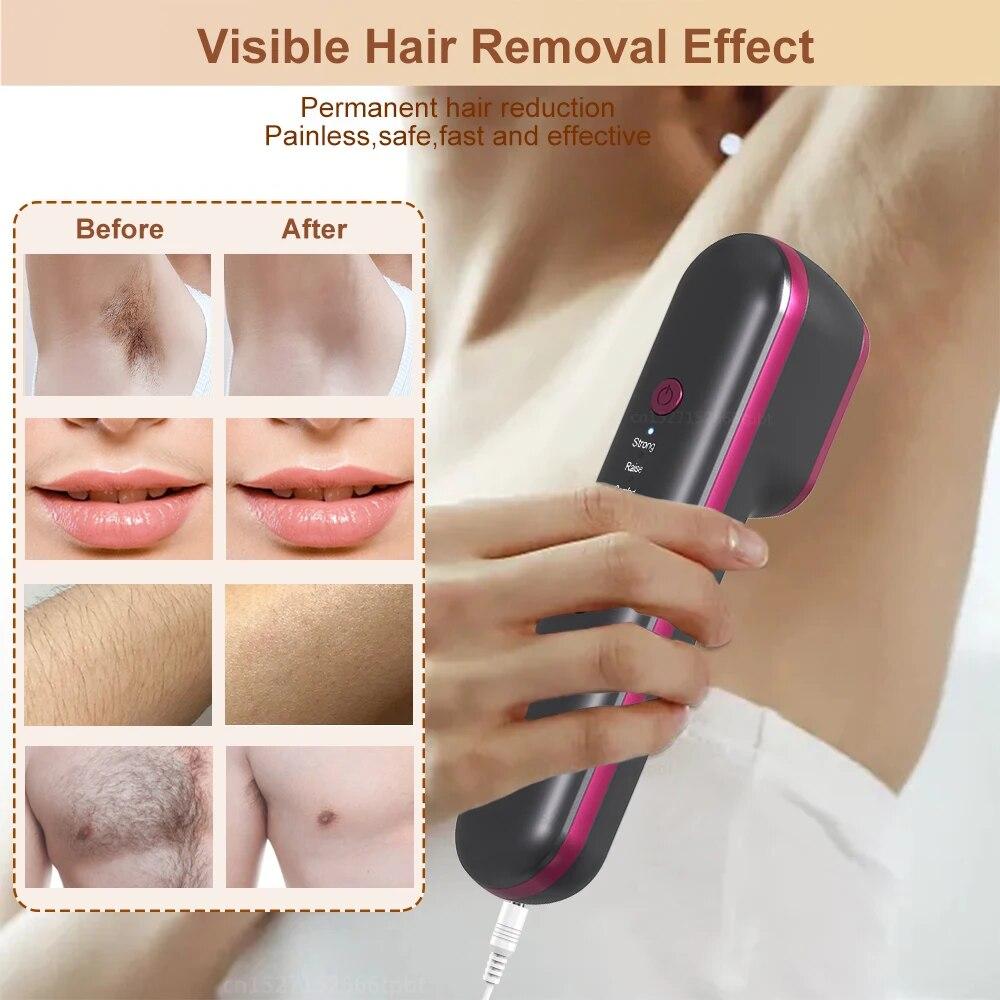 Устройство для удаления волос с интенсивным импульсом, устройство для постоянного удаления волос, безболезненное устройство для удаления волос, устройство для фотонной эпиляции для салонов красоты/дома