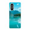 Для Huawei Nova 10 Чехол 10Pro Прозрачный Мраморный Мягкий ТПУ Силиконовый Задняя Крышка Для Huawei Nova 10 Pro Чехол для Телефона Funda Coque Nova10 Pro