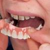 Extra Thin Fake Bright White Tooth Veneers Silicone Soft Safe Adhesive Denture Hide Shade Braces Comfortable Teeth Orthodontic F4