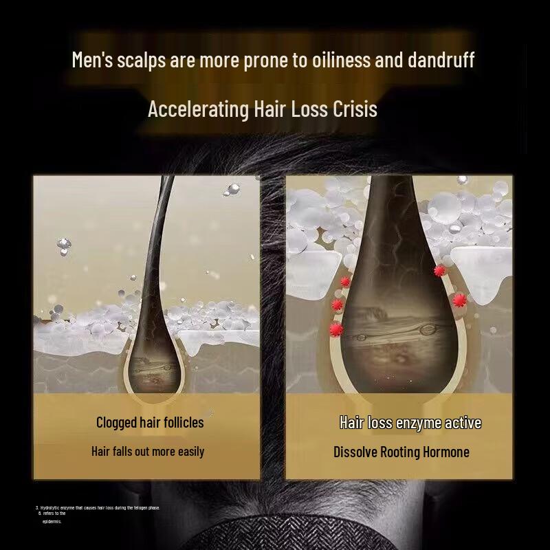 CLEAR Men Anti-Hair Loss & Strengthening Shampoo