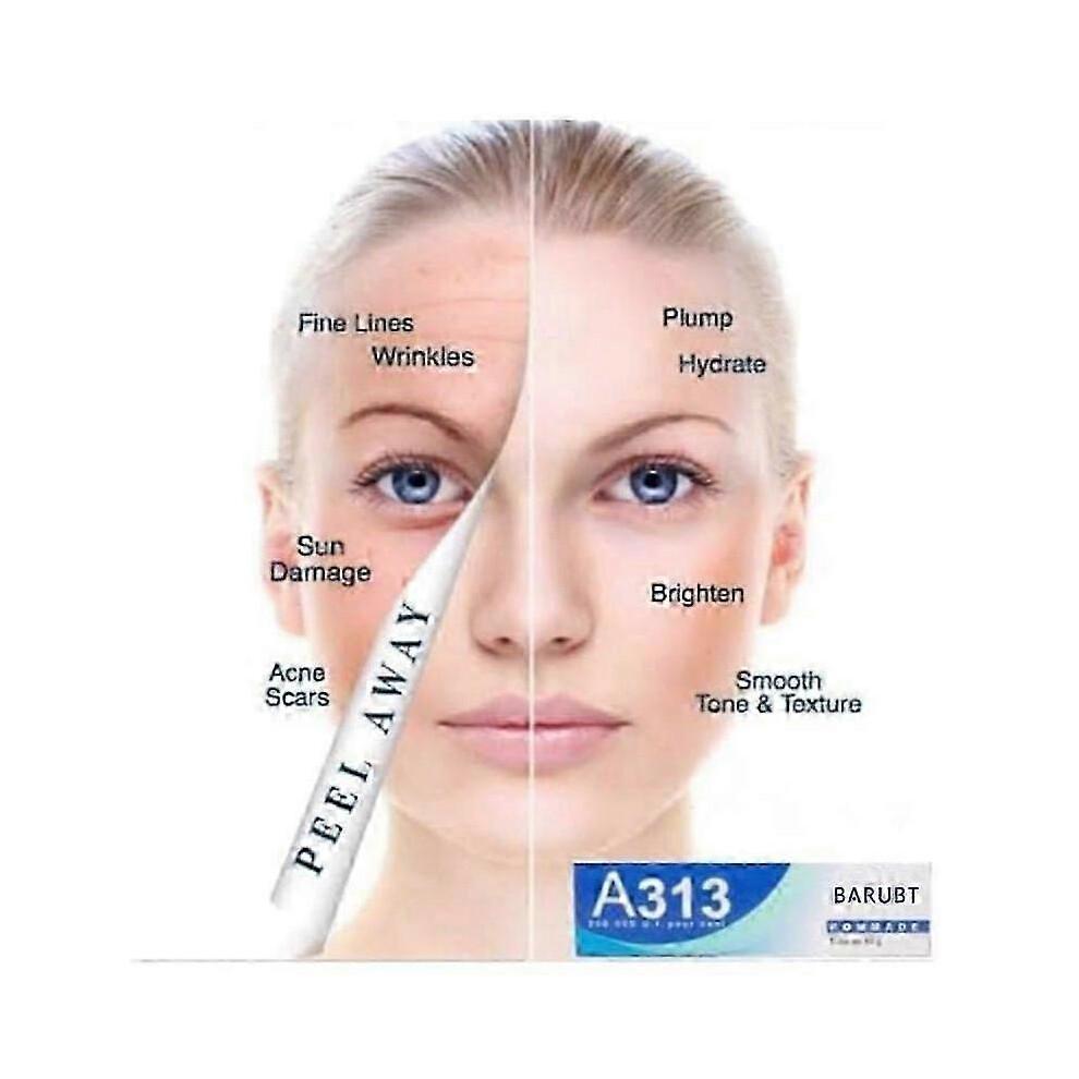 A-313 Vitamin A Retinol Cream A~313 Retinol Anti-Aging Cream for Face, Reduces Pores & Wrinkles, Treats Acne & Dark Spots-Ideal Gifts less