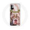 Case for Xiaomi Redmi Note 10T 5G Brown Pitbull Dog