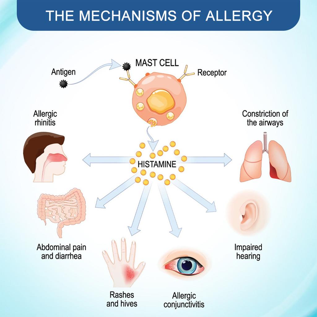 Крем для ухода за экземой, дерматитом, крапивницей, мазью от зуда кожи, массажным пластырем