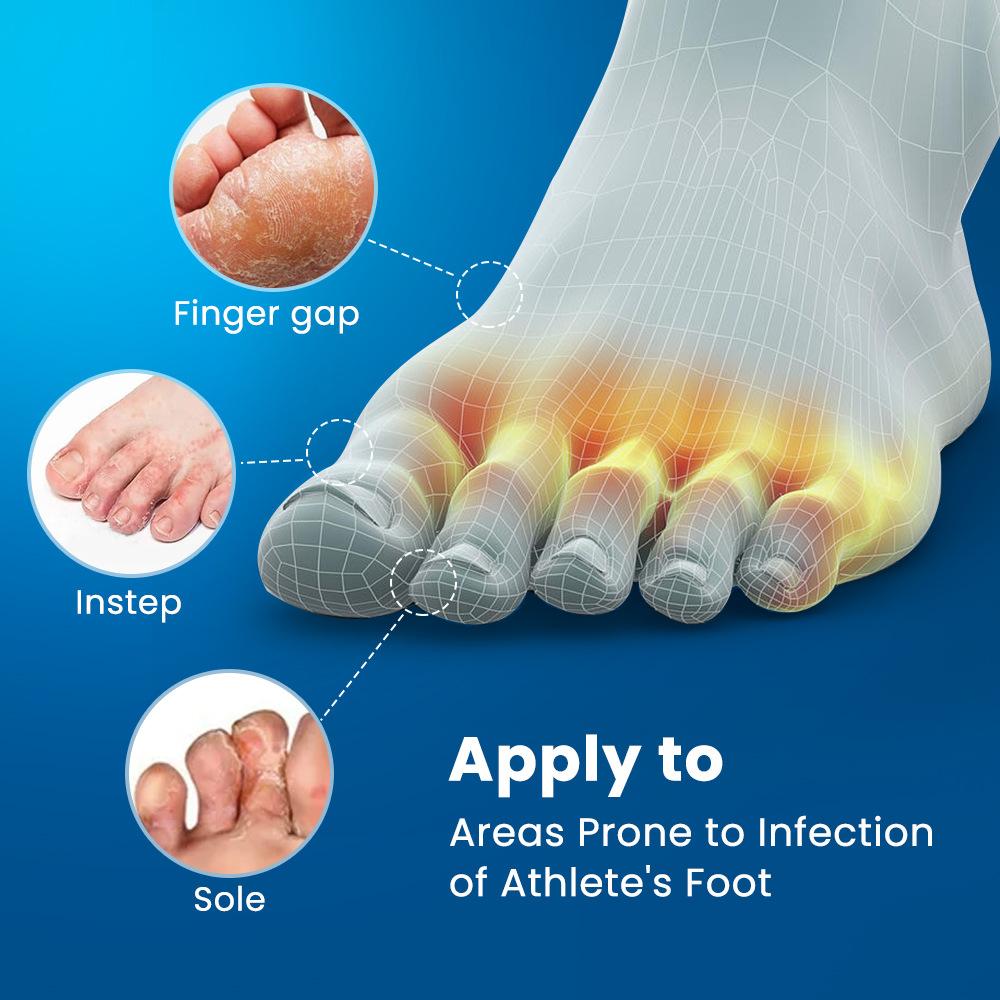 Крем для ног Sumifun Anti-Itch от грибка ногтя на ногах, увлажняющий и успокаивающий крем для ухода за ногами
