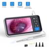TESLONG 4.5 Inch IPS Color Screen Digital Otoscope 1.0MP 1080P HD 3.9mm Lens Ear Inspection Camera 6 LEDs IP67