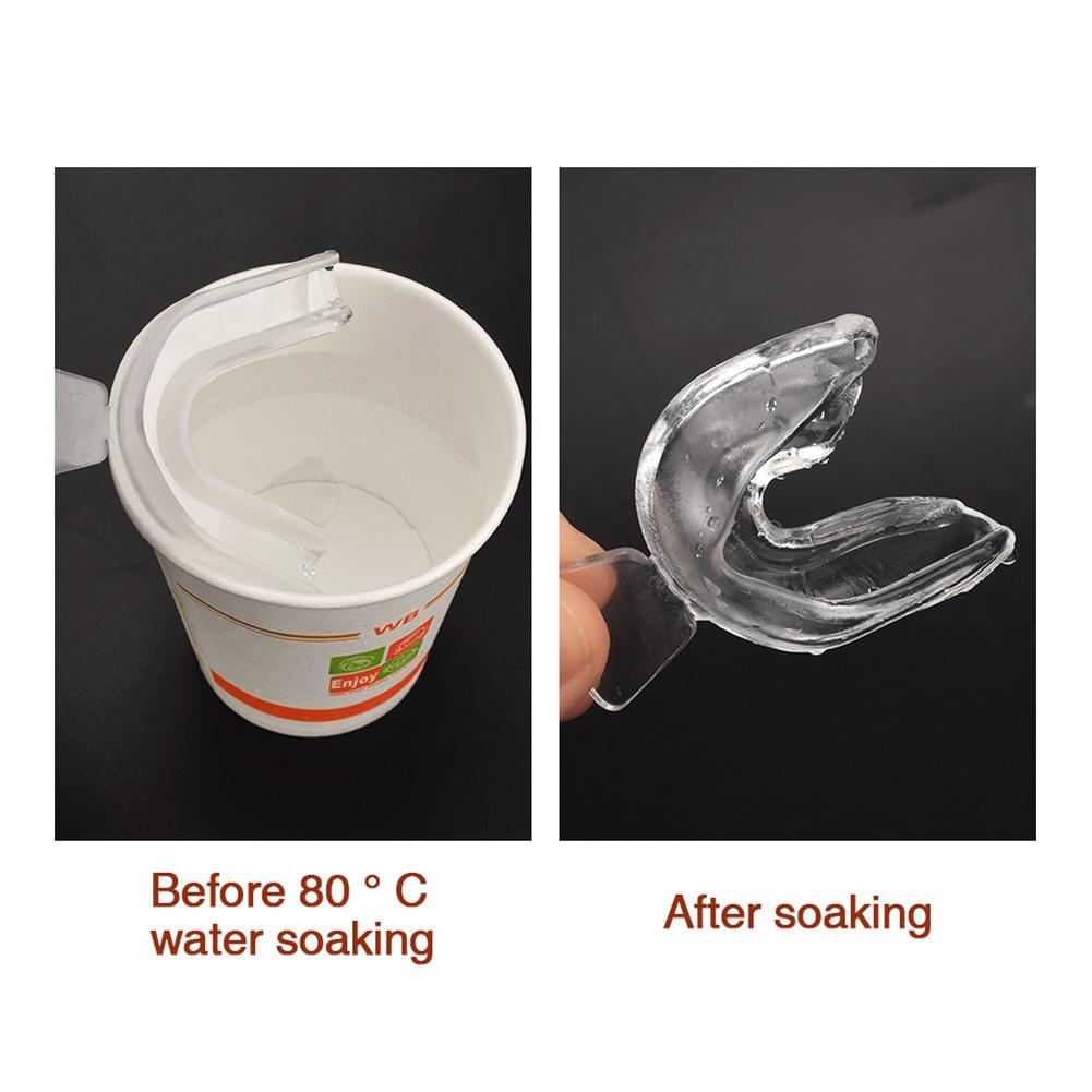 2/4 шт. Зубной ортодонтический аппарат-тренажер для выравнивания, брекеты, тренажер для зубов для взрослых, инструменты для отбеливания, гигиенический уход