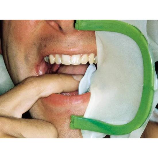Рамки для коффердама ET Dental