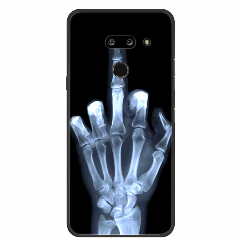 Для LG G8 G8S ThinQ Черные Чехлы Мягкий Силикон ТПУ Чехлы для Телефона Для G 8 S 8S ThinQ Роскошная Задняя Крышка Funda Мультяшный Чехол Para Capa