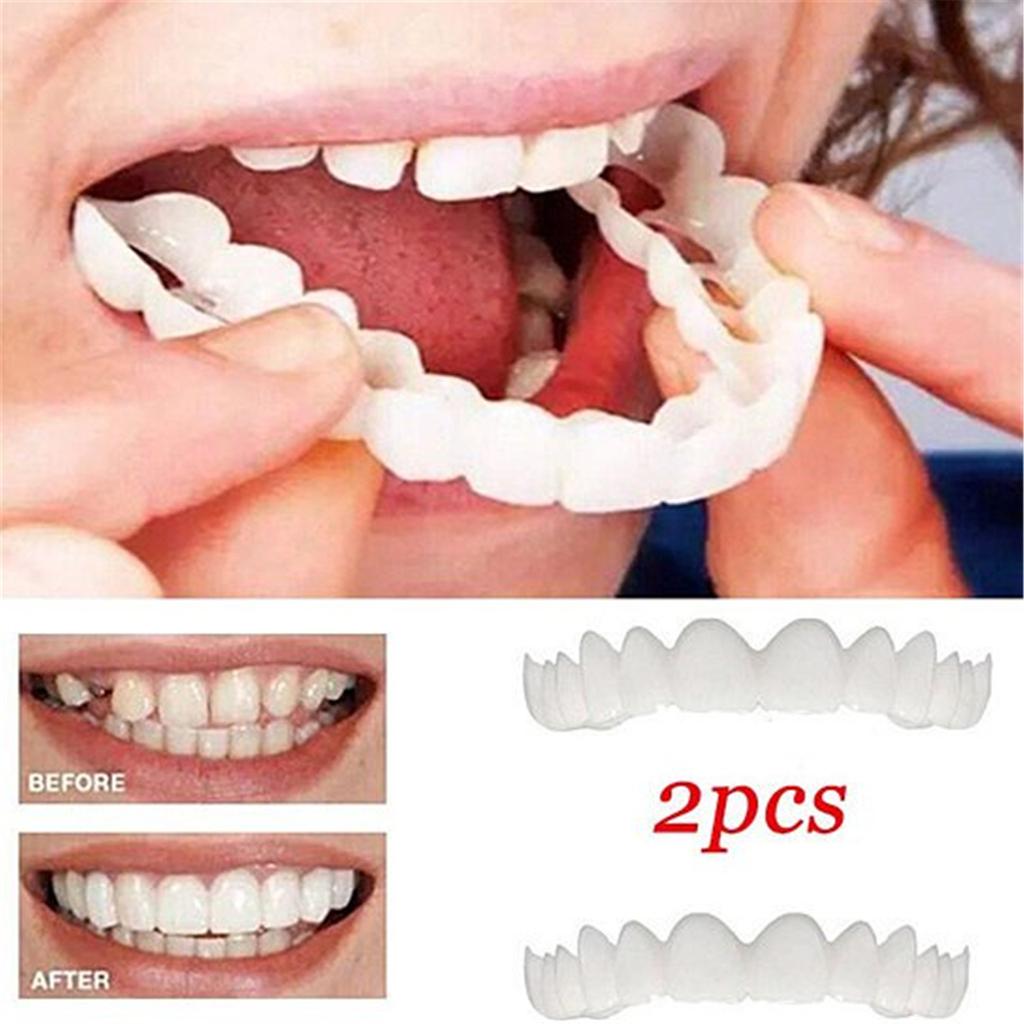 2Pcs/Set Cosmetic Teeth Comfort Fit White Fake Teeth Cover Top Veneer Denture Kit