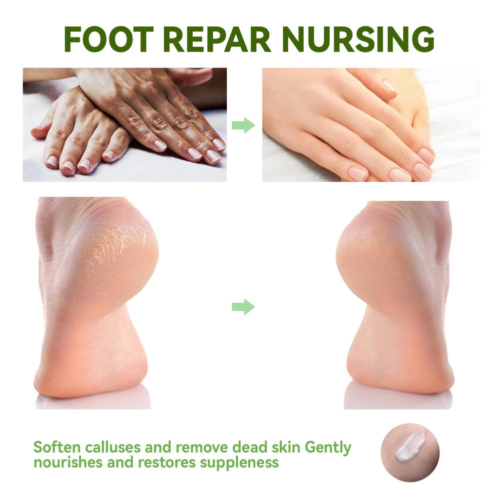 50g Urea Foot Cream Hand Anti Cracking Moisturizing Calluses Dead Skin Repair Rehydration Soften Cuticle Smooth Restore