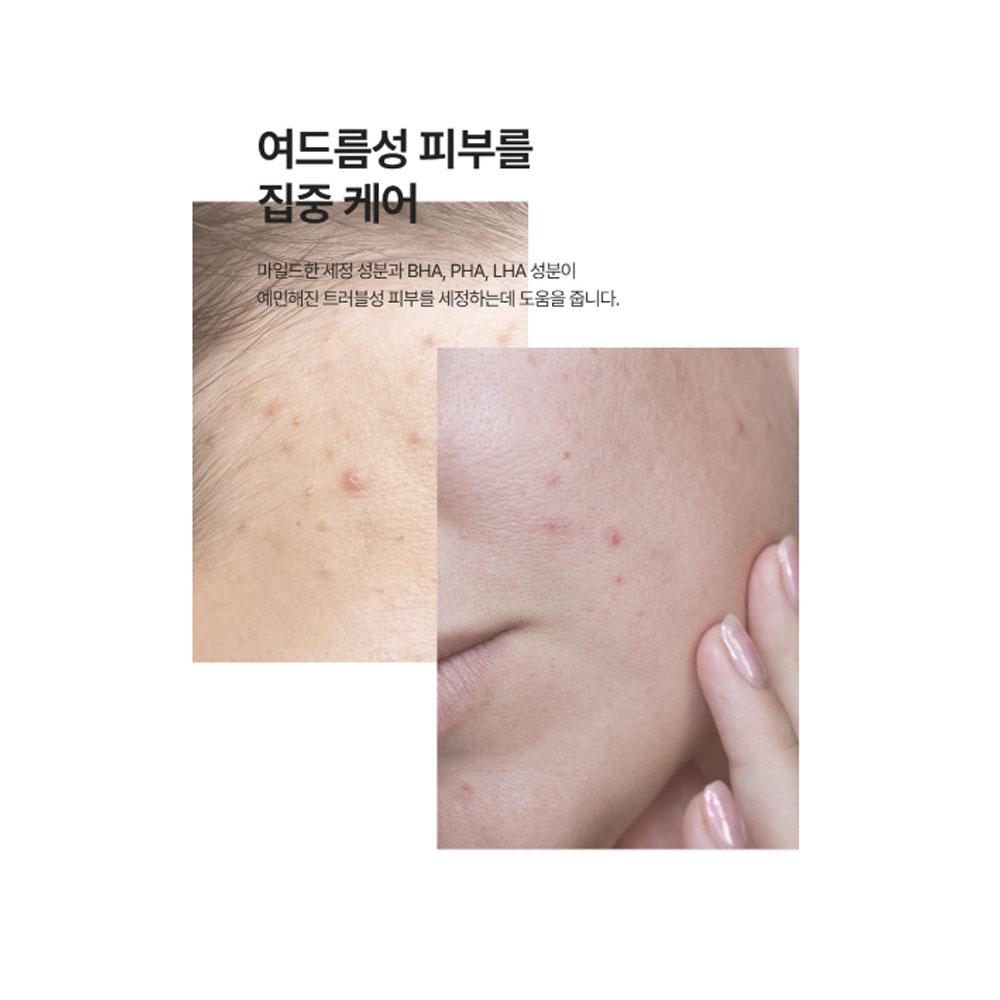 vancor Пенка для умывания с BHA-кислотой от прыщей 120 мл