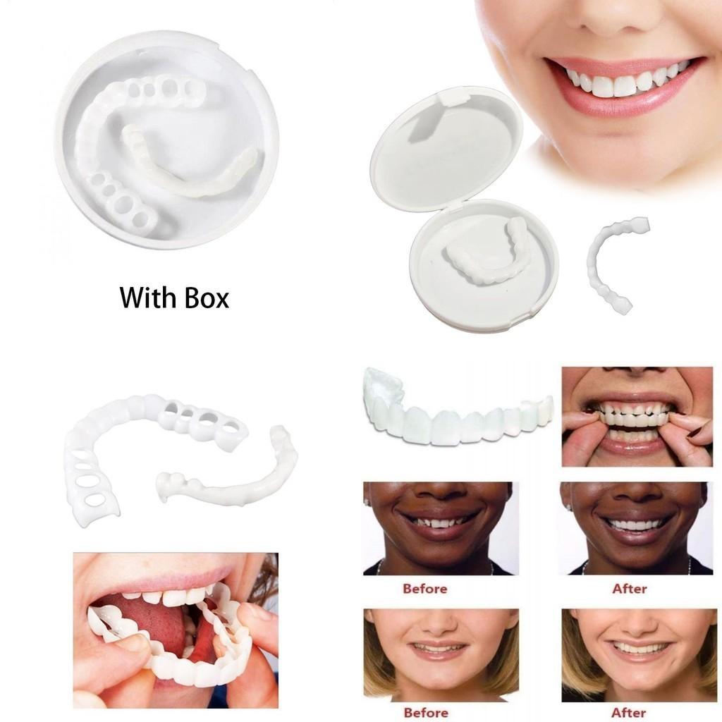 On Fake Snap Teeth Upper Lower Dental Veneers Denture Tooth Cover Simulation Set