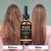 Ginger Hair Growth Oil Conditioner HAIR GROWTH SERUM