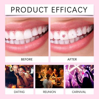 Professional Tooth Gem Kit Diy Love Horse Eye Crystals Jewelry Kit Teeth Gems Kit Tooth Gems For Teeth Teeth Jewelry Starter