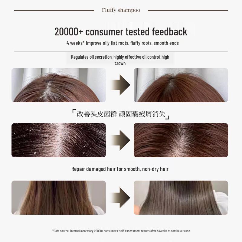 QINGYAN Sulfur Anti-Dandruff & Oil Control Shampoo