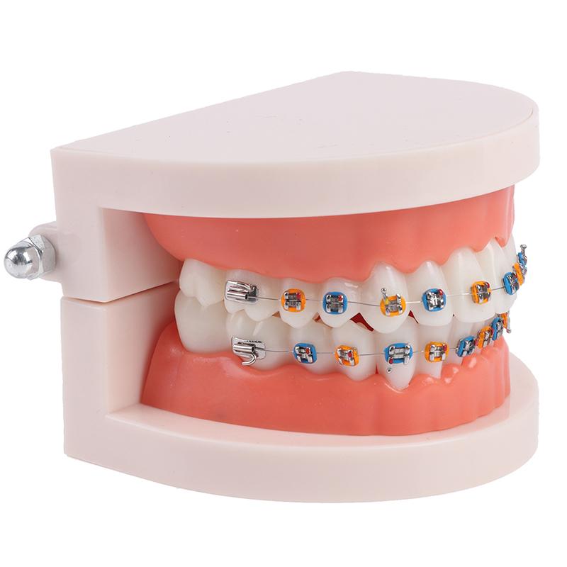 Зубоврачебная ортодонтическая модель зубов с учебным оборудованием школы металлических брекетов