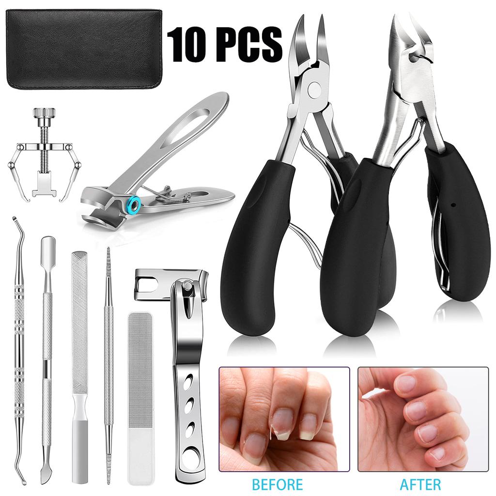 Набор из 10 щипчиков для удаления вросшего ногтя из нержавеющей стали. Набор щипчиков для удаления вросшего и толстого ногтя.