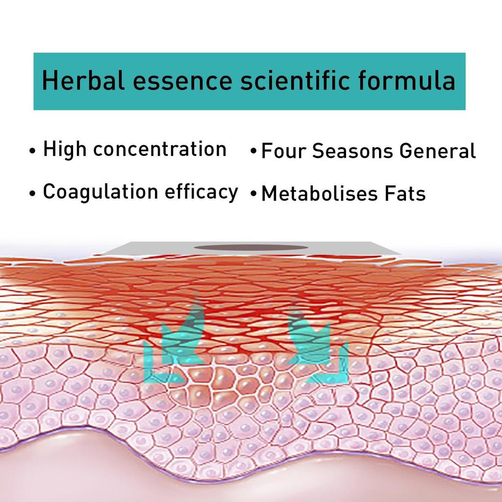 Пластырь для похудения, Пластырь для похудения, Пластыри для живота Пластырь для похудения для быстрого похудения, сжигания и подавления