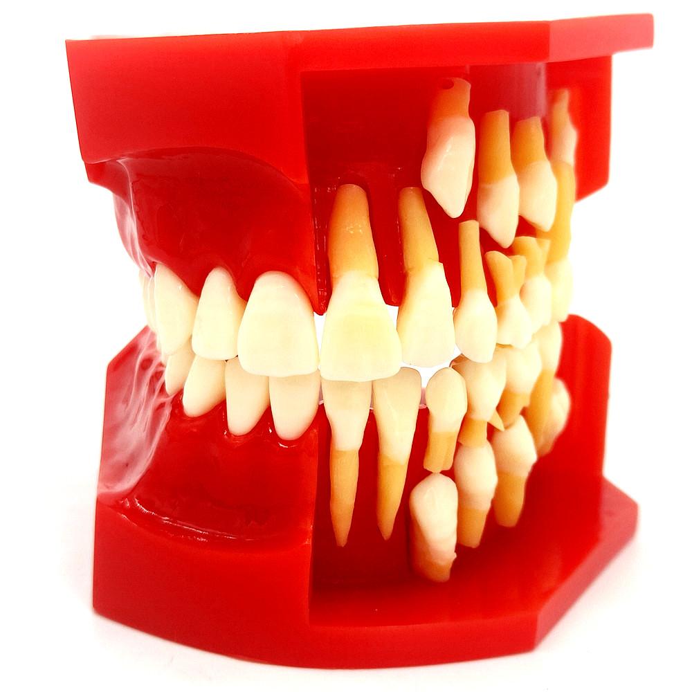 Стоматологическая детская модель молочных зубов Сменная модель Постоянные зубы Альтернативный дисплей Съемная демонстрация для обучающих моделей стоматологов