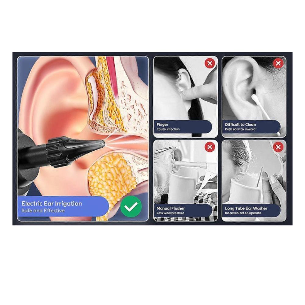 Удобный очиститель ушей, инструмент для чистки ушной серы, электрический очиститель ушей