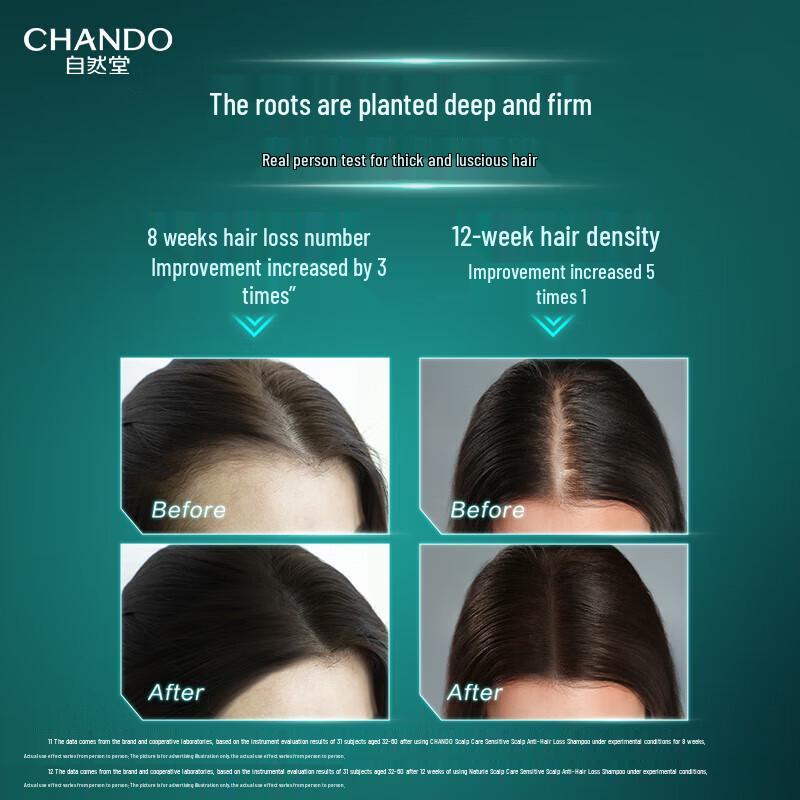 CHANDO Sensitive Scalp Anti-Itch Shampoo & Conditioner Set