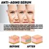Ouhoe Collagen Anti-Aging Essence For Reducing Fine Lines And Nasolabial Folds On The Face, Hydrating, Moisturizing And Anti-Wrinkle Essence