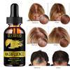 5ML/15ML/30ML/50ML/ Rice Hair Growth Spray Anti Hair Loss Treatment Serum Fast Growth Longer Thicker Hair for Men Women