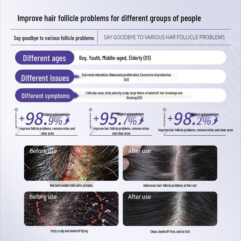 Медицинский шампунь CVKK с коллагеном против перхоти и зуда для лечения себорейного дерматита.