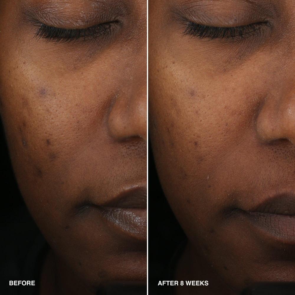 Bobbi Brown Витаминная обогащенная разглаживающая сыворотка с ниацинамидом 1,01 унции