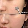 Stainless Steel Acne Remover Scooper Double Headed Extractor Pore Cleaner  Women Beauty