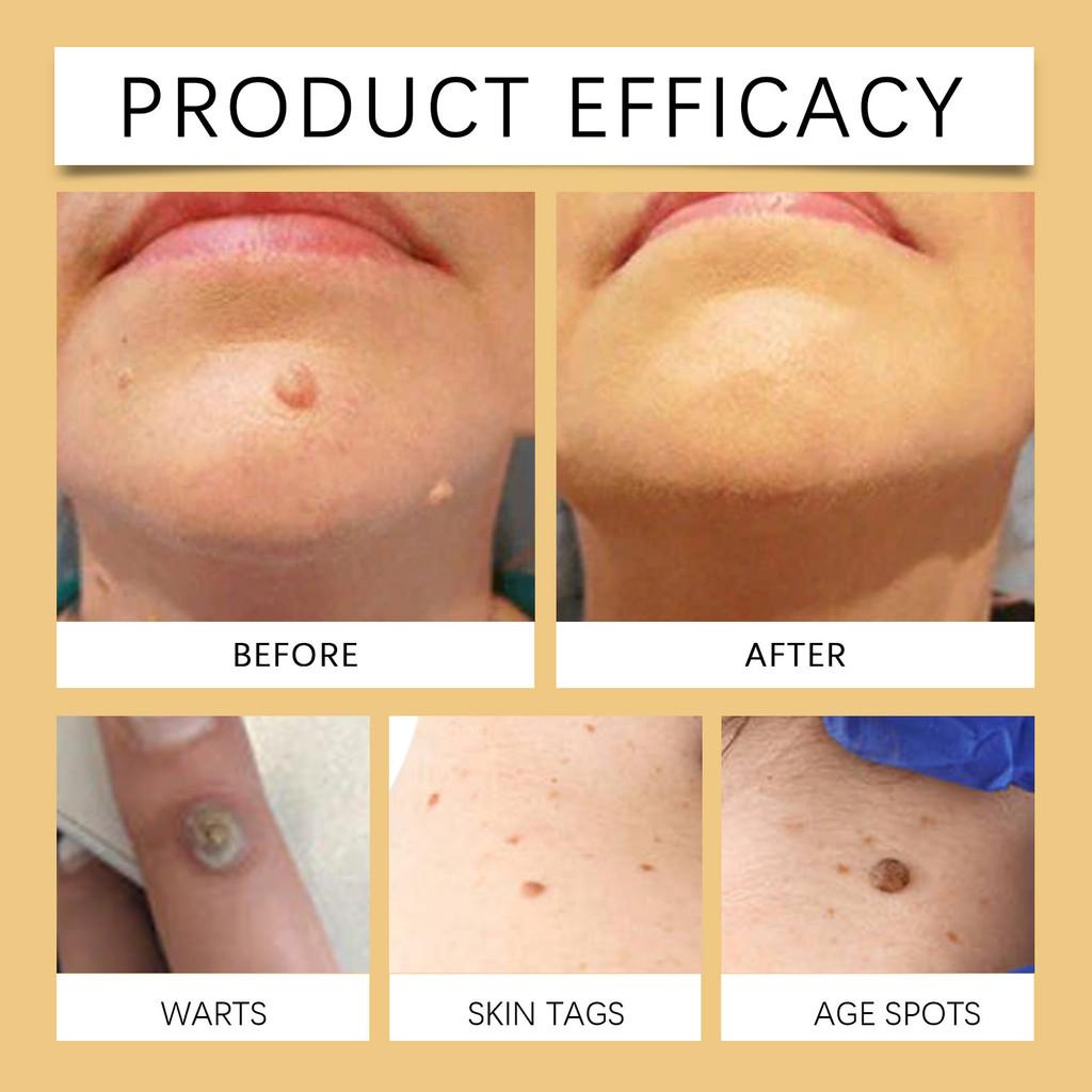 Крем для ухода за кожей с пчелиным ядом Wiyun Нежная травяная формула для осветления пигментных пятен 60 г