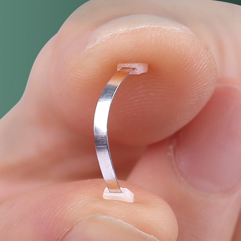 Orthopedic Nail Groove Curl Nail Lala Orthopedic Patch Toenail Long Fleshy Inlaid Nail Traction Orthopedic Button Orthosis