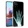 Прозрачный чехол для телефона для Redmi 14C 13C 10C 10 9 Note 13 12 11 K50 K40 Plus Pro 4G 5G Мягкий ТПУ чехол Осень Рентген Кости Руки