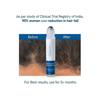 1PCS Be Bodywise Hair Growth Serum Roll On - 3% Rosemary, 3% Redensyl & 2% - (25ml)