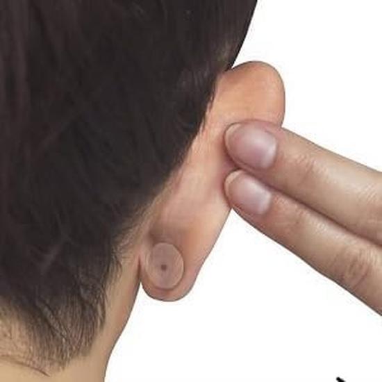 Waterproof Earlobe Support Patches Makes Torn, Stretched Earlobe no Longer Visible (Pack of 30 Stickers)
