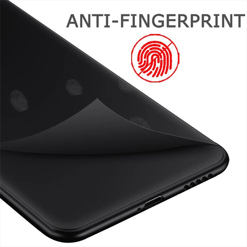 Чехол для телефона с милой собакой сибирского хаски для Iphone Xiaomi Mi Redmi Samsung Galaxy Note S 9 10 11 12 13 22 Pro Max Plus Uitra Черный Мягкий Мини из ТПУ