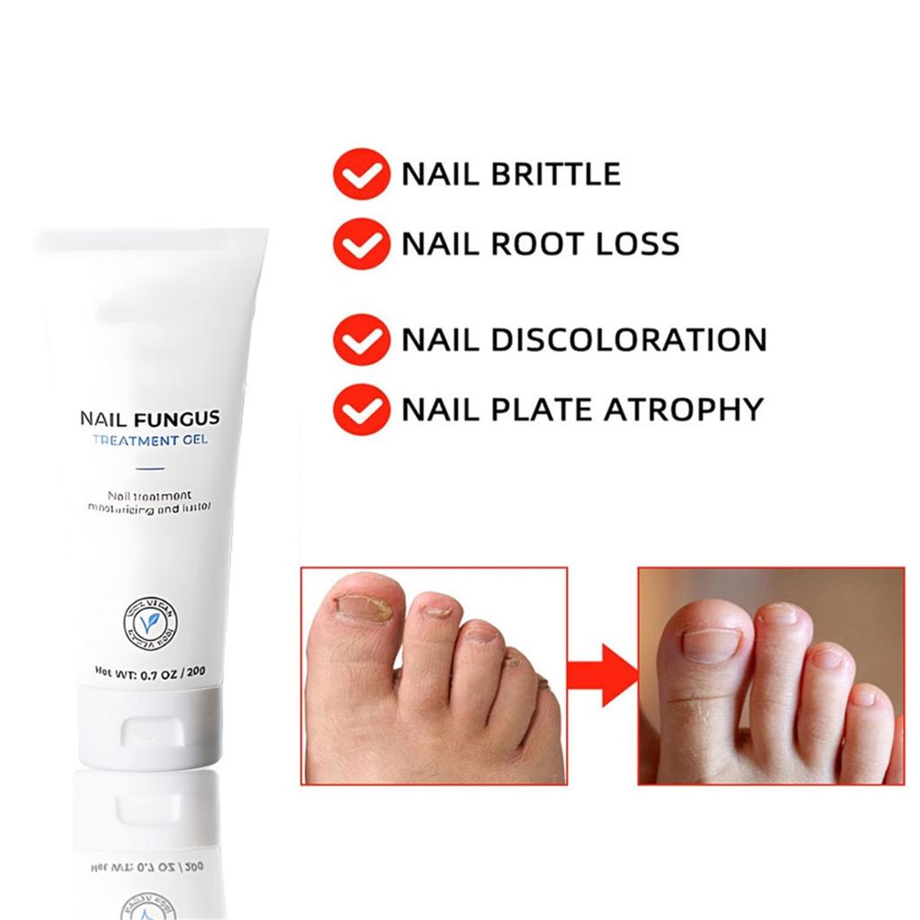 Nail TreatGel, новый Healio Nail TreatGel, для ломких, слоящихся, тонких ногтей, укрепление ногтей, Nail GrowthTreat 20 г