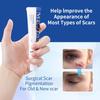 Scar Removing Cream Fade Acne Scars Color Moisturizing Fades Scars Gel Skin Care Body Cream