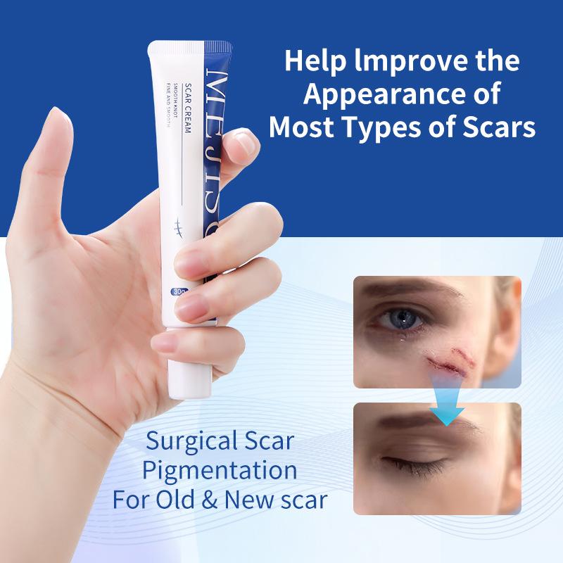 Scar Removing Cream Fade Acne Scars Color Moisturizing Fades Scars Gel Skin Care Body Cream