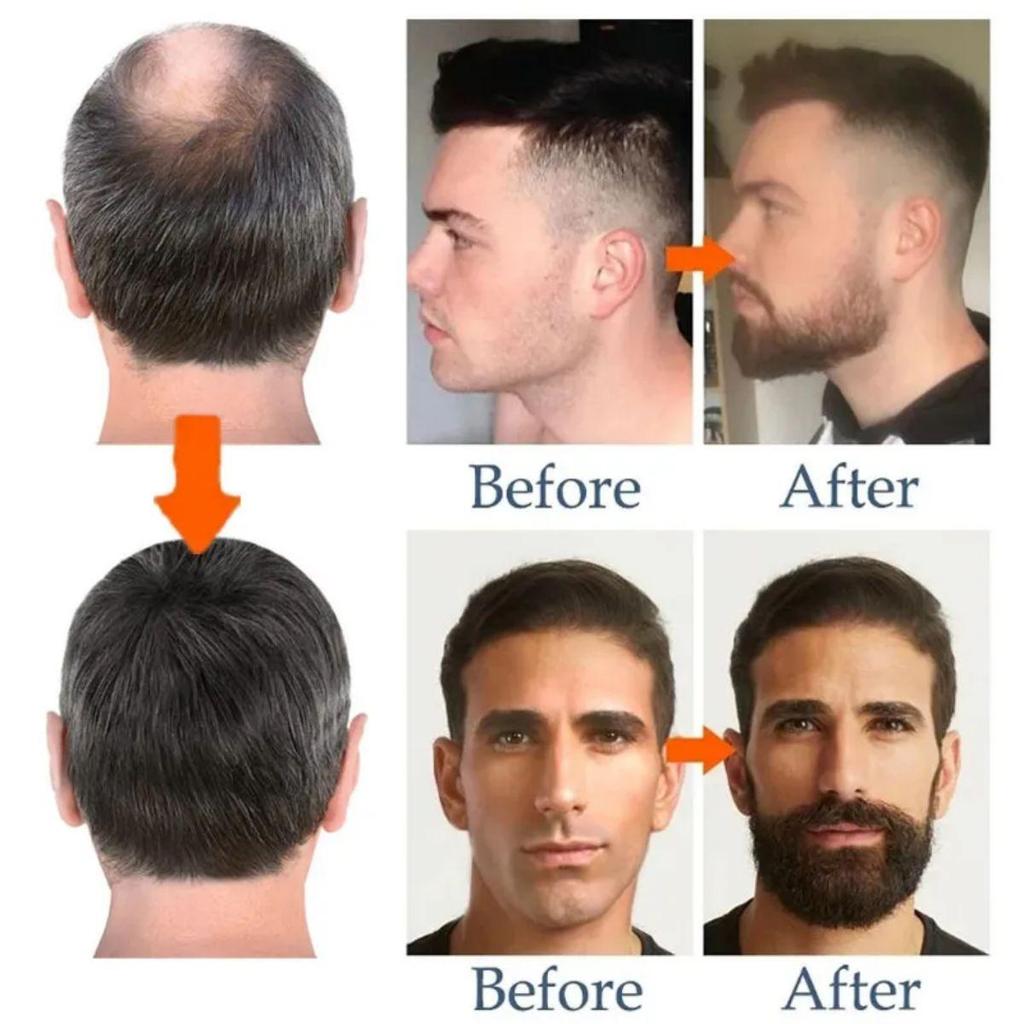 Beard Oil Hair Oil for Fast Hair Growth Beard Hair Growth