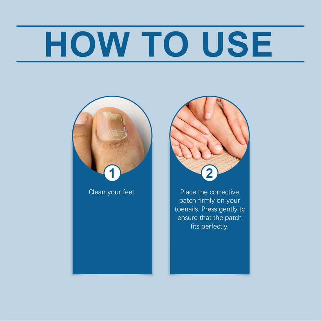 Патч для коррекции ногтей на ногах Улучшает состояние ногтей, Помогает в и Ухаживает за Патчами для ногтей