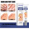 Nail Gel Anti-infective Nail Care Hand And Foot Gentle Non-irritating Nail Essence